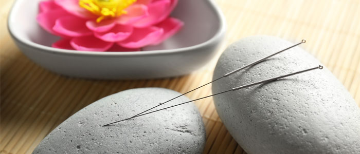 acupuncture needles